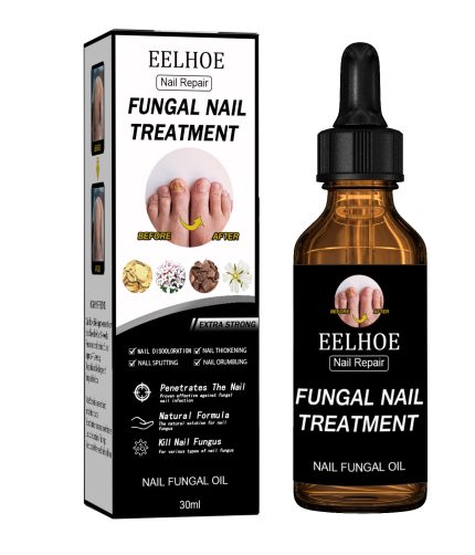 eelhoe nail repair solution soft nail thickening type onychomycosis repair solution foot bright nail care solution K1